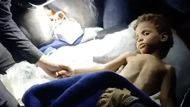 Un pequeño sin camiseta está siendo atendido por paramédico