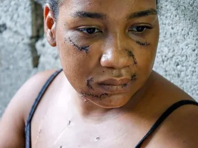 Mujer sobrevive a brutal ataque de su expareja en La Vega